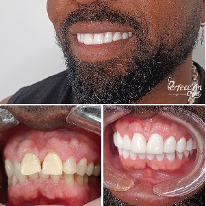 perfeccion oral_Mesa de trabajo 1